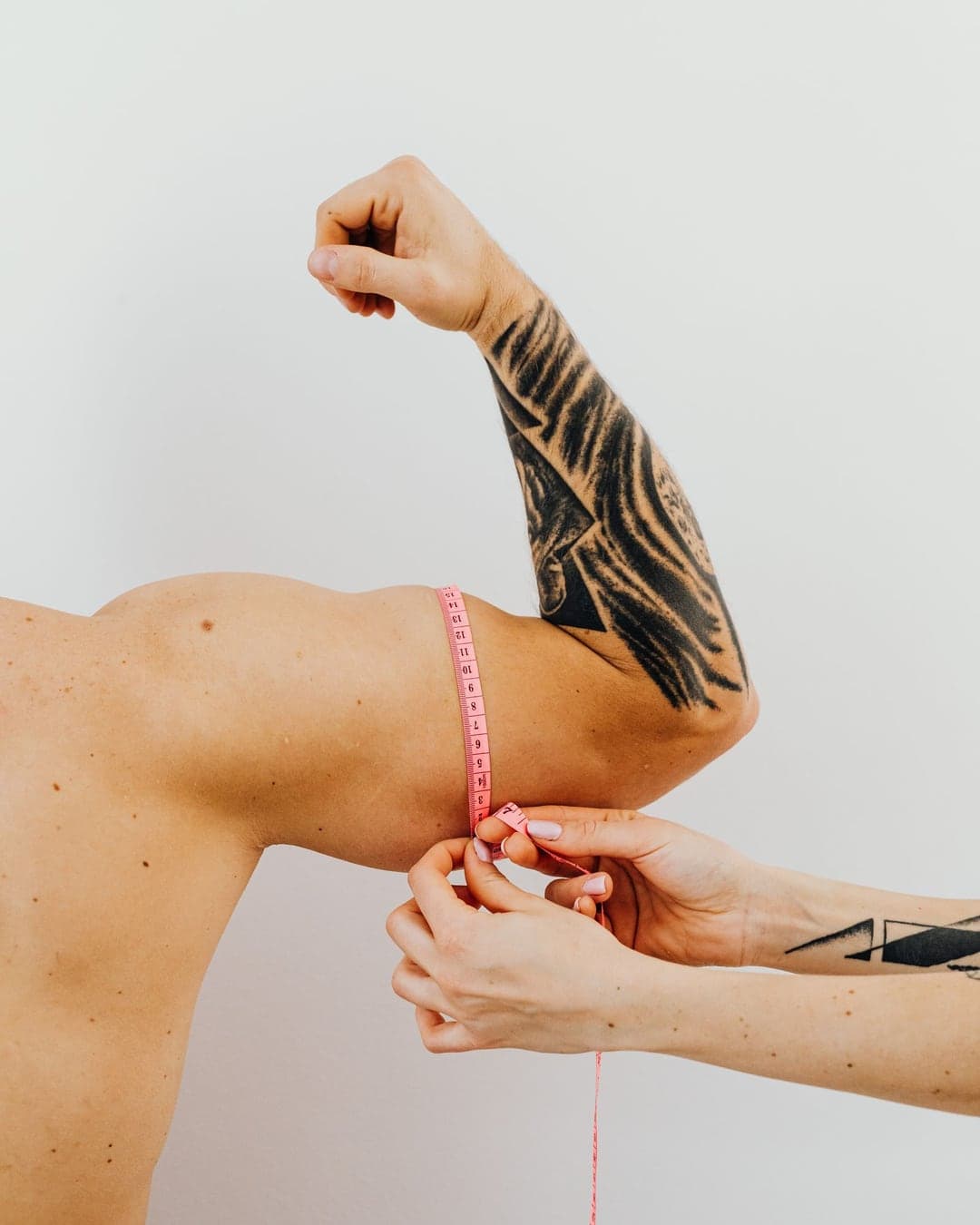 Arm Lift