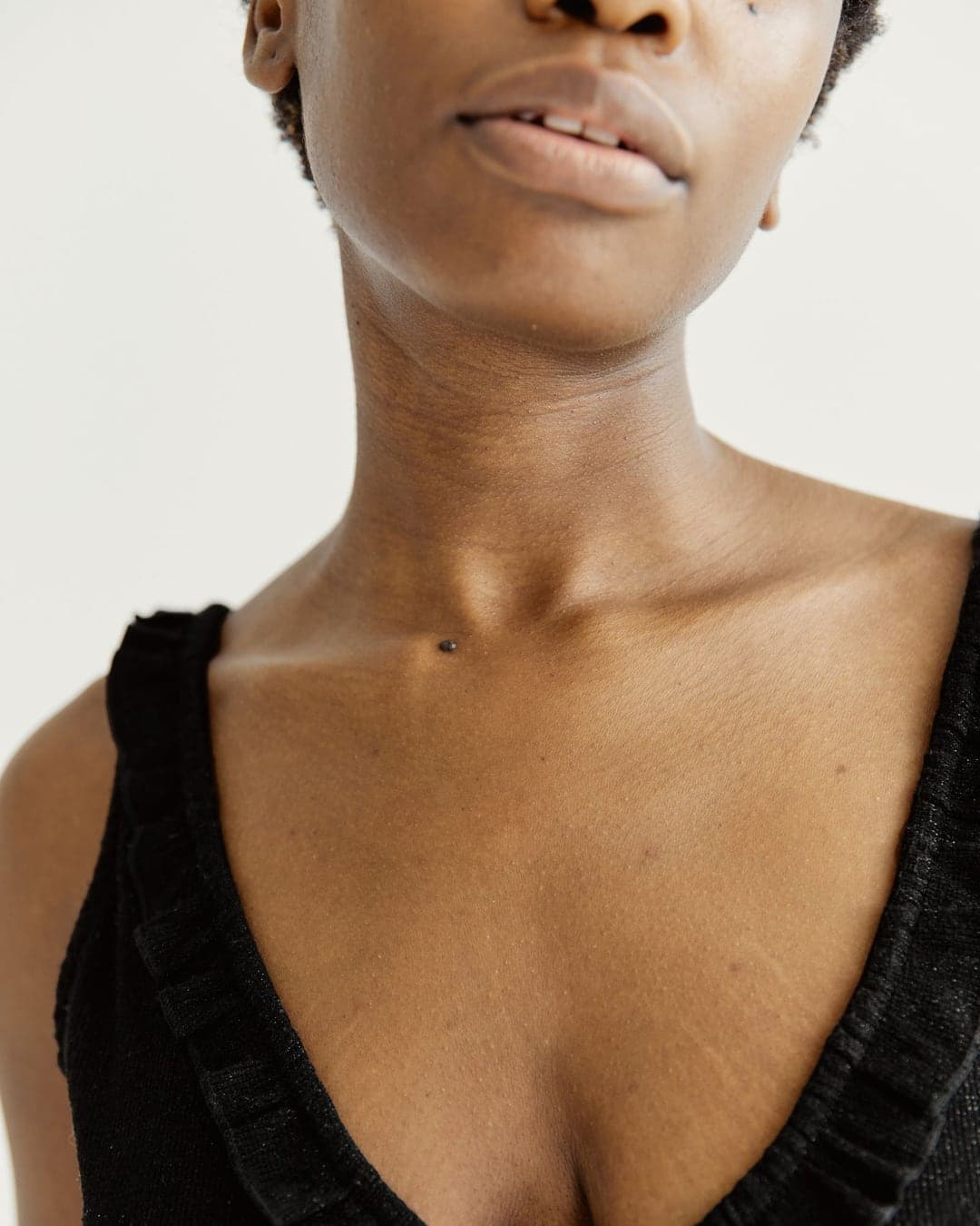 Breast Augmentation