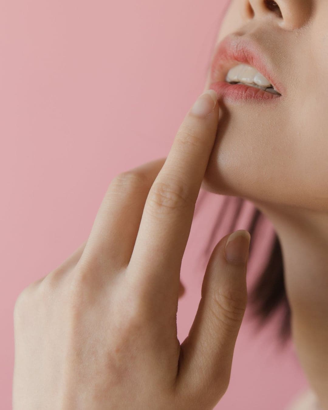 Dermal Fillers
