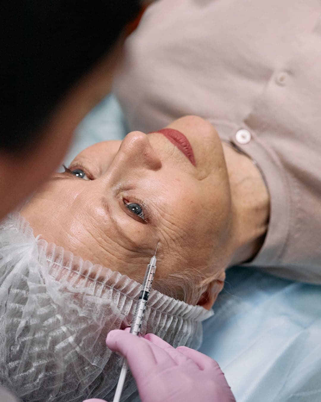 Facelift