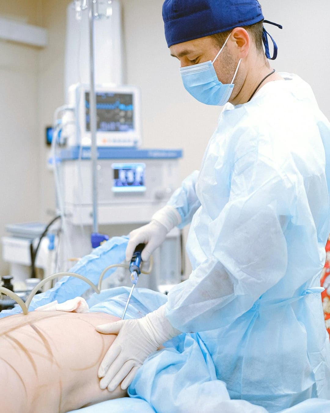Hi-Definition Liposuction