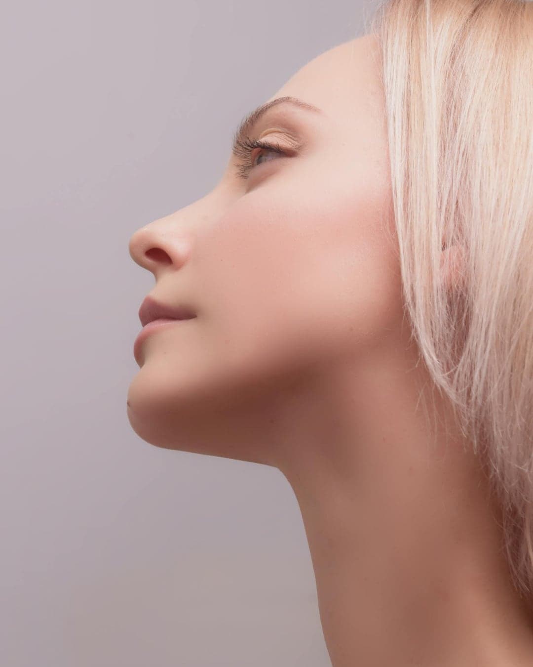 Neck Lift